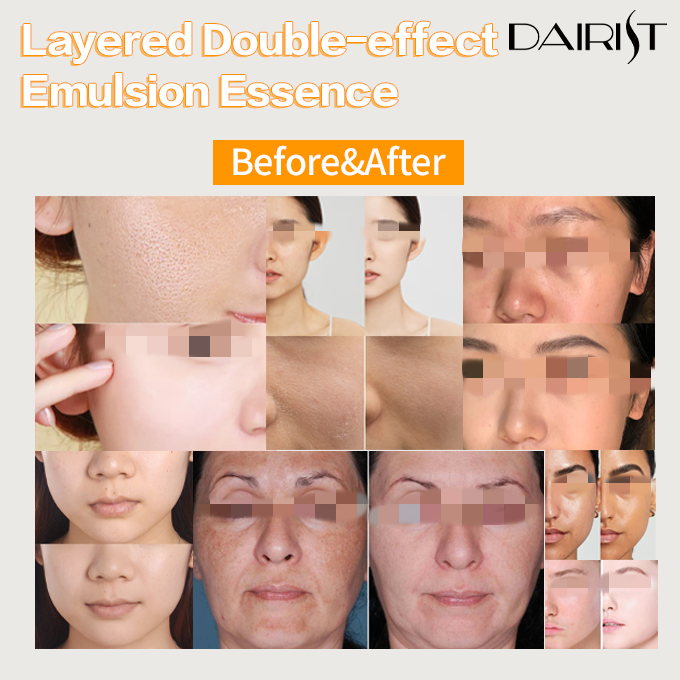 DAIRIST Layered Double-effect Emulsion Essence