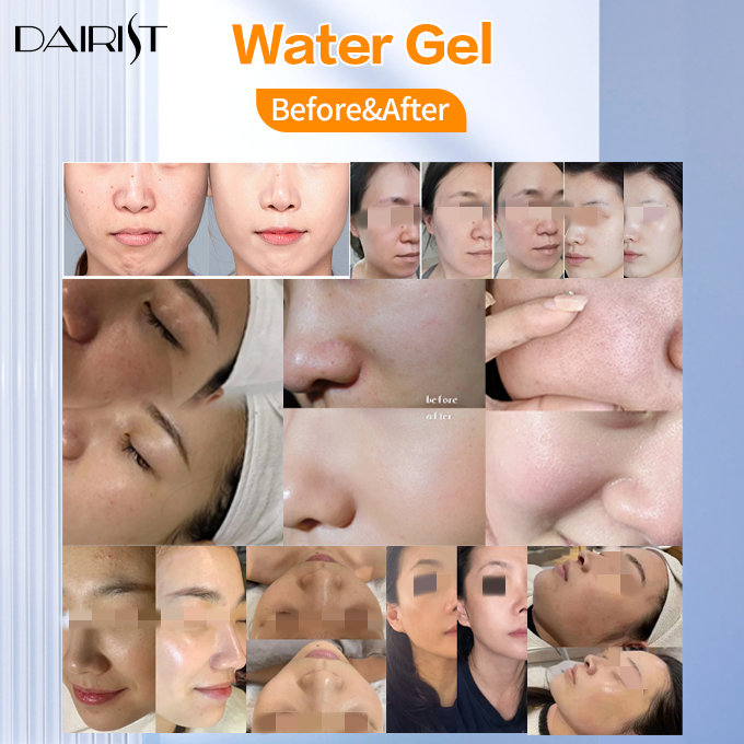 DAIRIST Water Gel