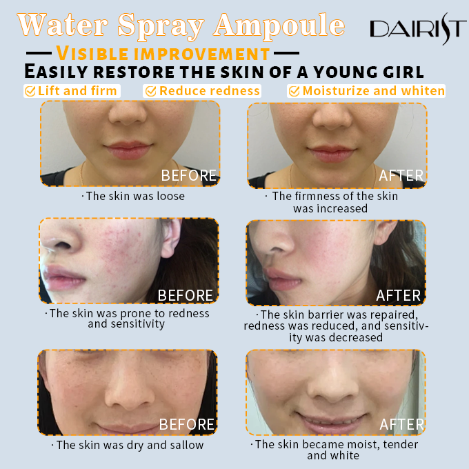 DAIRIST Water Spray Ampoule
